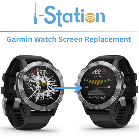 Garmin Venu Repair Service i Station Mobile Phone Electronic Device Repair and Accessories